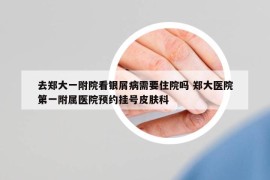 去鄭大一附院看銀屑病需要住院嗎 鄭大醫(yī)院第一附屬醫(yī)院預約掛號皮膚科