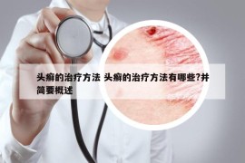 頭癬的治療方法 頭癬的治療方法有哪些?并簡要概述