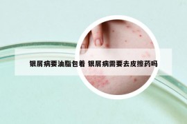 銀屑病要油脂包著 銀屑病需要去皮擦藥嗎