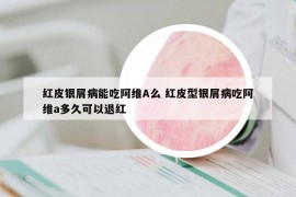 紅皮銀屑病能吃阿維A么 紅皮型銀屑病吃阿維a多久可以退紅