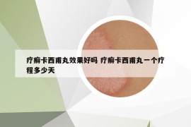 療癬卡西甫丸效果好嗎 療癬卡西甫丸一個(gè)療程多少天