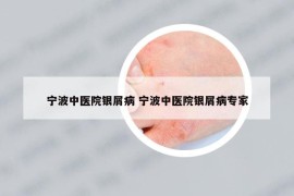 寧波中醫(yī)院銀屑病 寧波中醫(yī)院銀屑病專家