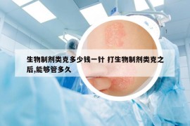 生物制劑類克多少錢一針 打生物制劑類克之后,能夠管多久