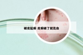 破皮起癬 皮癬破了就出血