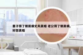 妻子得了銀屑病丈夫離婚 老公得了銀屑病,好想離婚