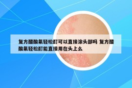 復(fù)方醋酸氟輕松酊可以直接涂頭部嗎 復(fù)方醋酸氟輕松酊能直接用在頭上么