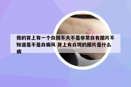 我的背上有一個白斑不大不是非常白有圖片不知道是不是白癜風(fēng) 背上有白斑的圖片是什么病