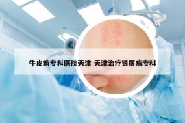 牛皮癬?？漆t(yī)院天津 天津治療銀屑病?？? /></a>		
		</figure>

		<header class=