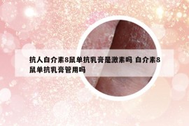 抗人白介素8鼠單抗乳膏是激素嗎 白介素8鼠單抗乳膏管用嗎