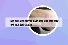 哈爾濱趙秀珍皮膚病 哈爾濱趙秀珍皮膚病醫(yī)院看臉上長(zhǎng)痘怎么樣