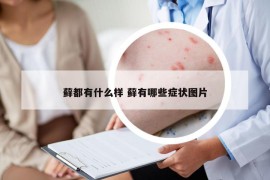蘚都有什么樣 蘚有哪些癥狀圖片