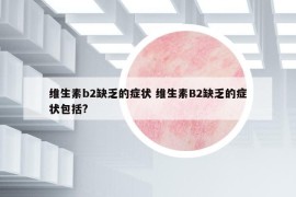 維生素b2缺乏的癥狀 維生素B2缺乏的癥狀包括?