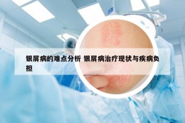 銀屑病的難點(diǎn)分析 銀屑病治療現(xiàn)狀與疾病負(fù)擔(dān)