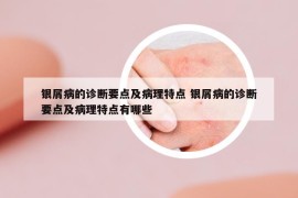 銀屑病的診斷要點及病理特點 銀屑病的診斷要點及病理特點有哪些