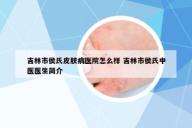 吉林市侯氏皮膚病醫(yī)院怎么樣 吉林市侯氏中醫(yī)醫(yī)生簡(jiǎn)介