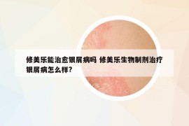 修美樂(lè)能治愈銀屑病嗎 修美樂(lè)生物制劑治療銀屑病怎么樣?