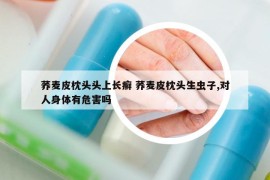 蕎麥皮枕頭頭上長(zhǎng)癬 蕎麥皮枕頭生蟲子,對(duì)人身體有危害嗎