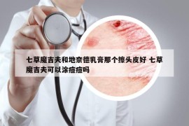 七草魔吉夫和地奈德乳膏那個(gè)擦頭皮好 七草魔吉夫可以涂痘痘嗎