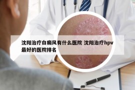 沈陽治療白癜風有什么醫(yī)院 沈陽治療hpv最好的醫(yī)院排名