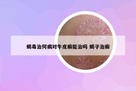 蝎毒治何病對牛皮癬能治嗎 蝎子治癬