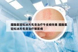 醋酸氟輕松冰片乳膏治療牛皮癬效果 醋酸氟輕松冰片乳膏治療銀屑病