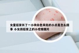 女童后背長(zhǎng)了一小塊白色突出的小點(diǎn)是怎么回事 小女孩后背上的小疙瘩圖片