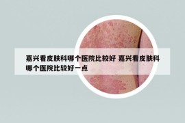 嘉興看皮膚科哪個(gè)醫(yī)院比較好 嘉興看皮膚科哪個(gè)醫(yī)院比較好一點(diǎn)