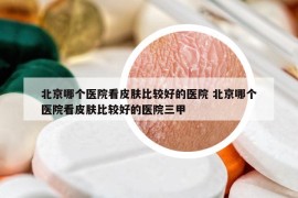 北京哪個醫(yī)院看皮膚比較好的醫(yī)院 北京哪個醫(yī)院看皮膚比較好的醫(yī)院三甲