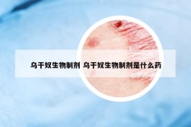 烏干奴生物制劑 烏干奴生物制劑是什么藥