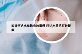 四針阿達(dá)木單抗有效果嗎 阿達(dá)木單抗打針視頻