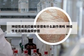 神經(jīng)性皮炎打曲安奈德有什么副作用嗎 神經(jīng)性皮炎醋酸曲安奈德