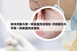鄭州河醫(yī)大第一附屬醫(yī)院皮膚科 河南醫(yī)科大學(xué)第一附屬醫(yī)院皮膚科