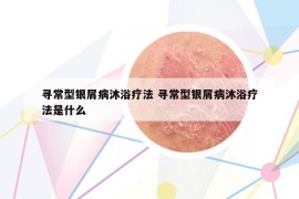 尋常型銀屑病沐浴療法 尋常型銀屑病沐浴療法是什么