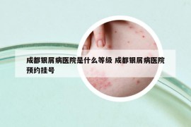 成都銀屑病醫(yī)院是什么等級(jí) 成都銀屑病醫(yī)院預(yù)約掛號(hào)