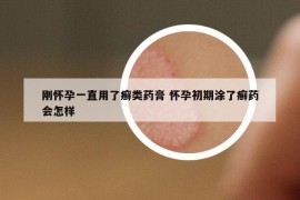 剛懷孕一直用了癬類藥膏 懷孕初期涂了癬藥會(huì)怎樣