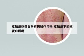 皮膚病吃蛋白粉有緩解作用嗎 皮膚病不能吃蛋白質(zhì)嗎