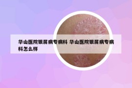 華山醫(yī)院銀屑病專病科 華山醫(yī)院銀屑病專病科怎么樣