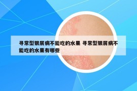 尋常型銀屑病不能吃的水果 尋常型銀屑病不能吃的水果有哪些