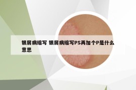 銀屑病縮寫 銀屑病縮寫PS再加個P是什么意思