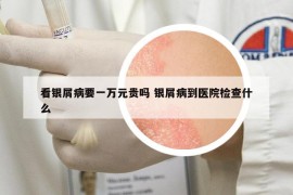 看銀屑病要一萬元貴嗎 銀屑病到醫(yī)院檢查什么