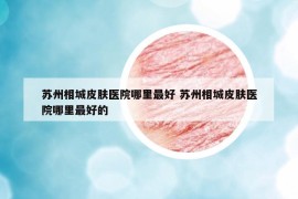蘇州相城皮膚醫(yī)院哪里最好 蘇州相城皮膚醫(yī)院哪里最好的