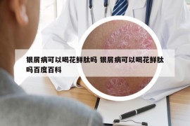 銀屑病可以喝花鮮肽嗎 銀屑病可以喝花鮮肽嗎百度百科
