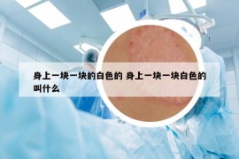 身上一塊一塊的白色的 身上一塊一塊白色的叫什么