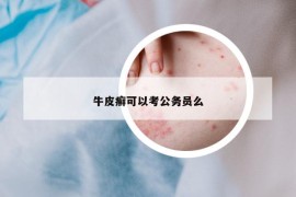 牛皮癬可以考公務(wù)員么