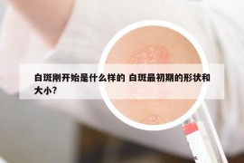 白斑剛開始是什么樣的 白斑最初期的形狀和大小?