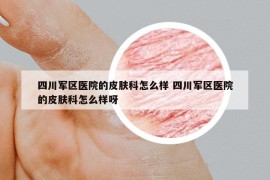 四川軍區(qū)醫(yī)院的皮膚科怎么樣 四川軍區(qū)醫(yī)院的皮膚科怎么樣呀