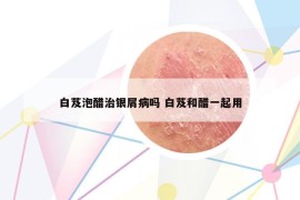 白芨泡醋治銀屑病嗎 白芨和醋一起用