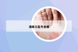 清除三亂牛皮癬