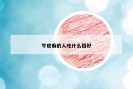 牛皮癬的人吃什么飯好