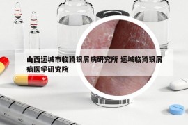 山西運城市臨猗銀屑病研究所 運城臨猗銀屑病醫(yī)學研究院